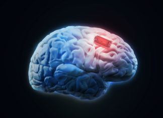 neuromodulation opioid treatment