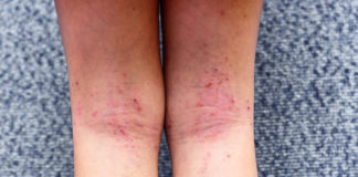 effects of drugs on skin