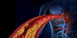 The link between cocaine addiction and vascular disease