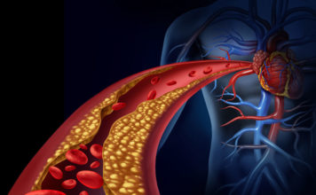 The link between cocaine addiction and vascular disease