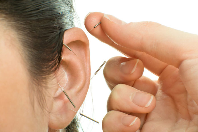 Addiction Recovery in Circleville Supplemented With Acupuncture Treatment